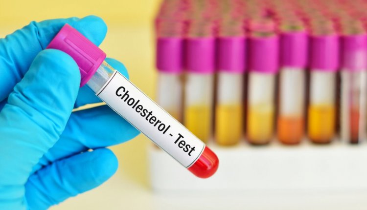 cholesterol-test